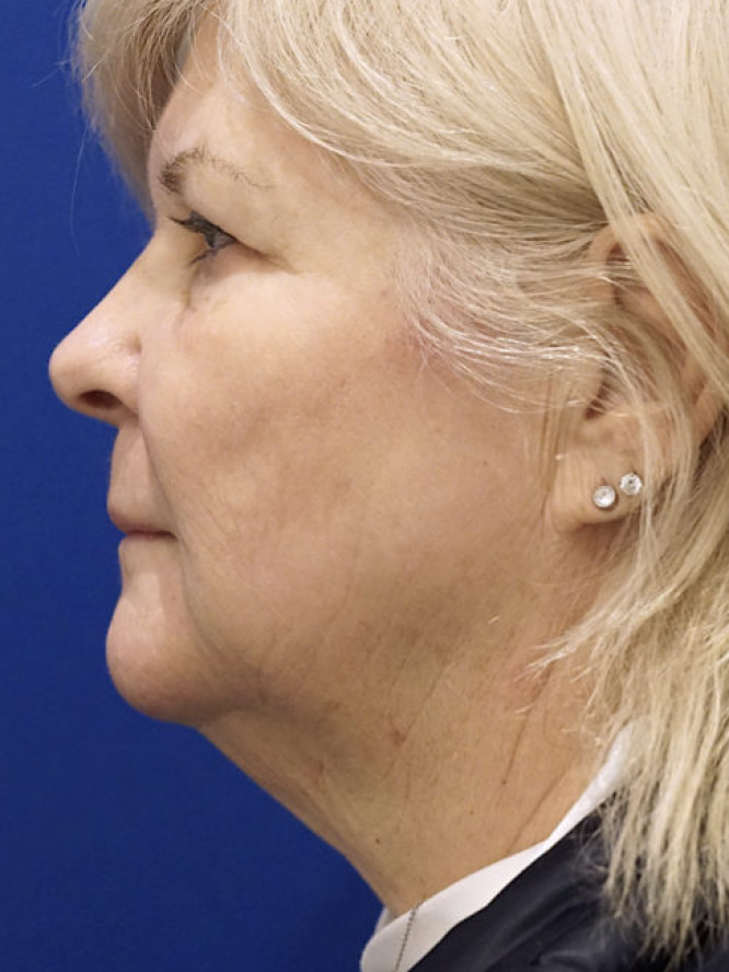 Amazing Transformation — Before