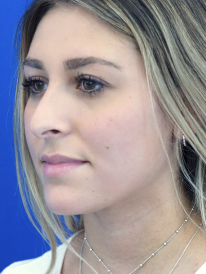 Beauty is Symmetry — Before