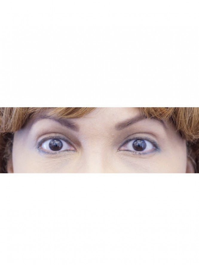 Elegant Eyelid Crease — After