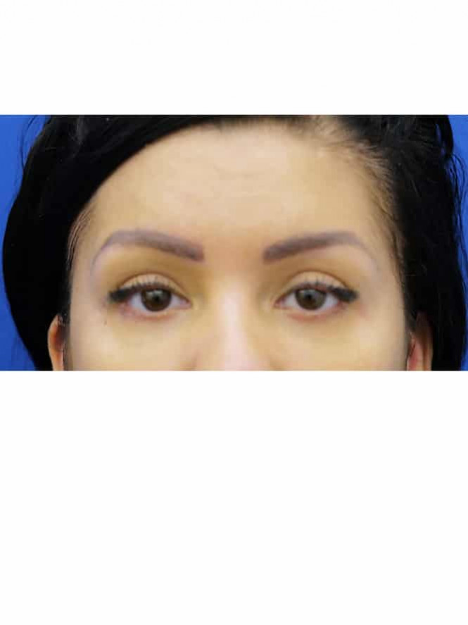 High Arched Brows — After