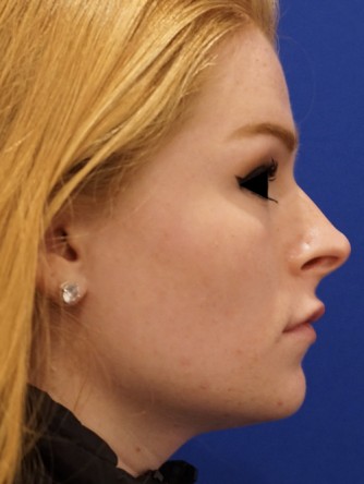 Tip and Lip* — After
