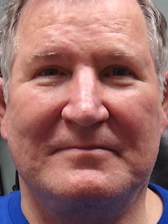 Aging Eyelid Rejuvenation, Facelift, Necklift 1* — After