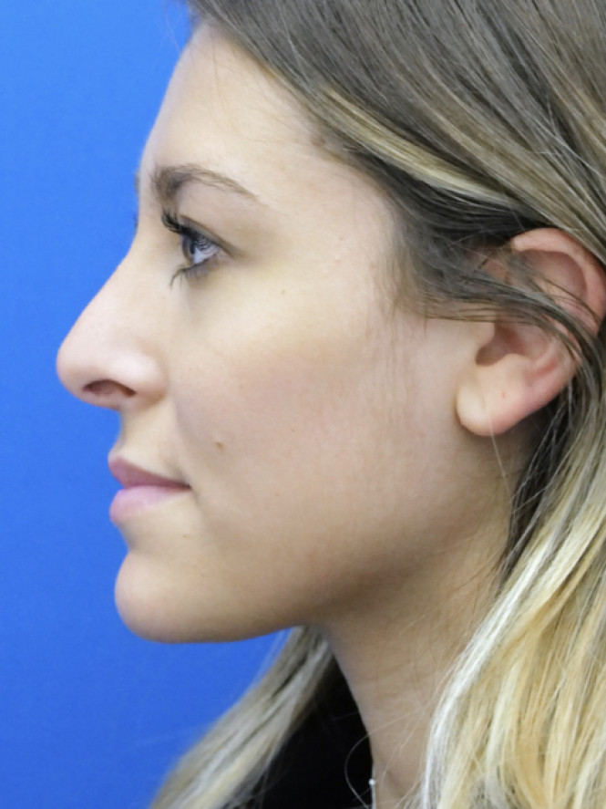 Beauty is Symmetry — After