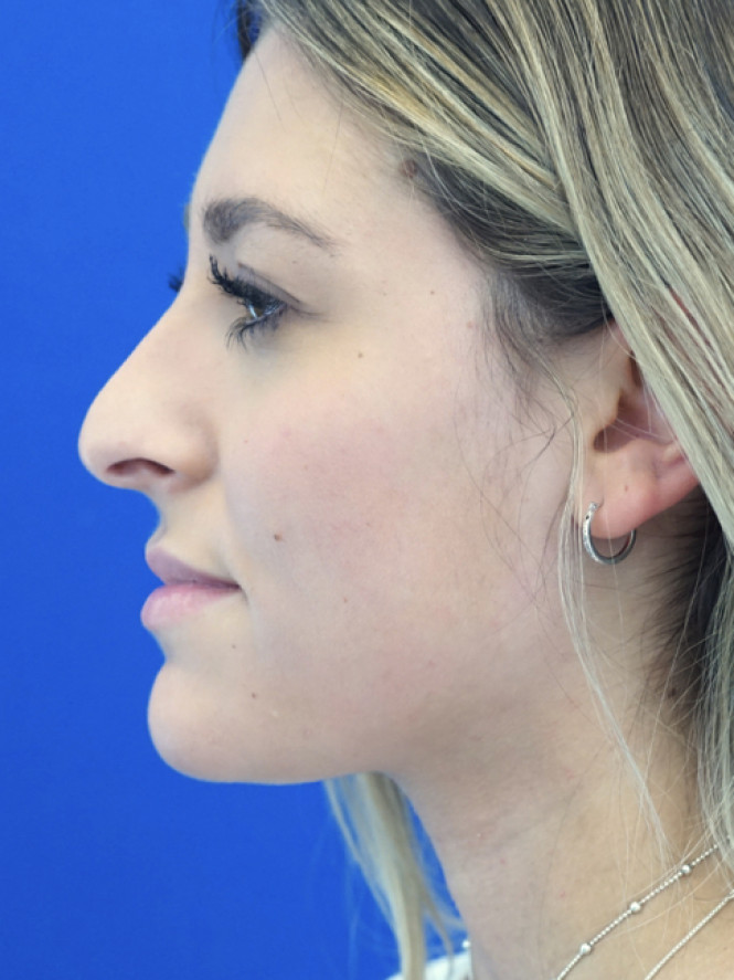 Beauty is Symmetry — Before