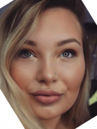 Restylane Silk Achieves Voluptuous Lips* — After