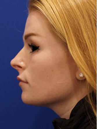 Tip and Lip* — After
