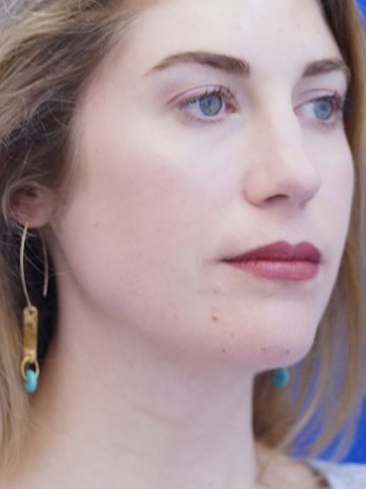 Chin LipoSculpture* — After