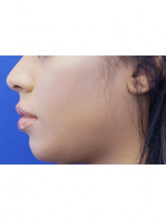 Microgenia* — After